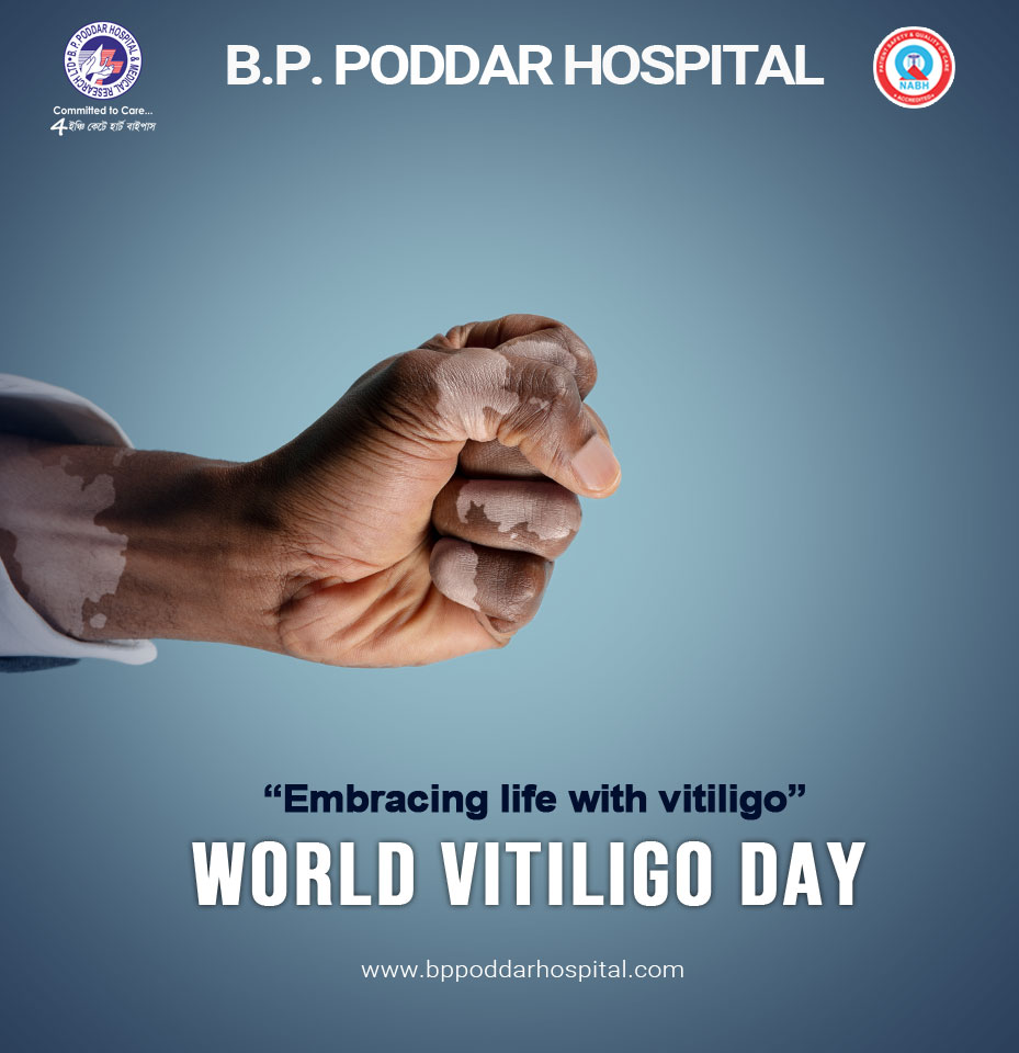 1 de agosto. Dia nacional dos portadores de vitiligo - OncoExpress