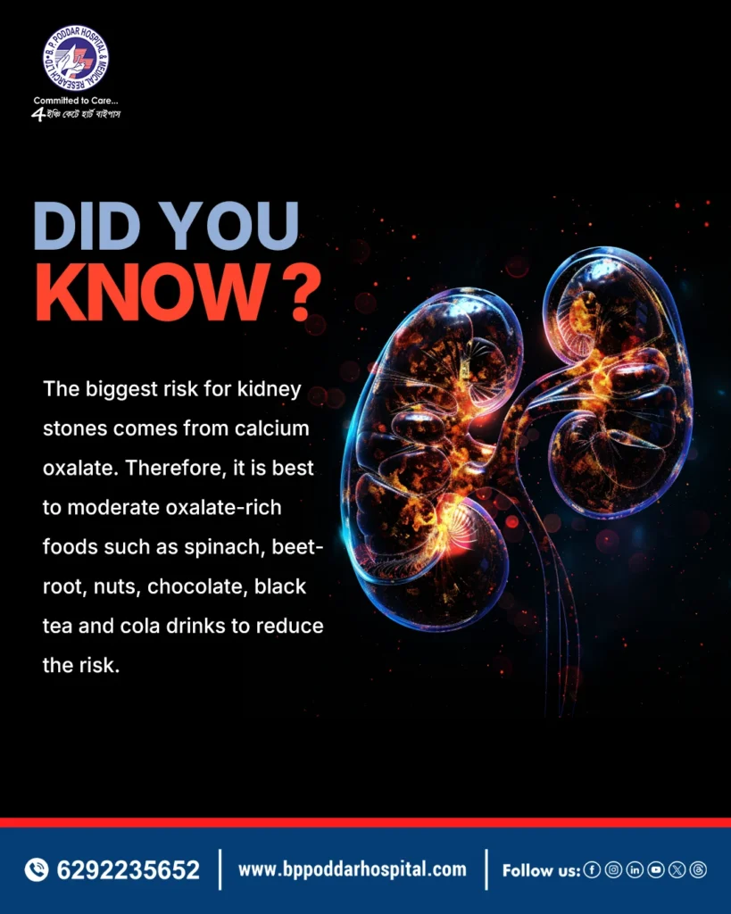 kidney stone